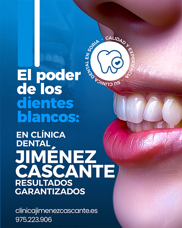 Blanqueamiento dental. Clínica Jiménez Cascante