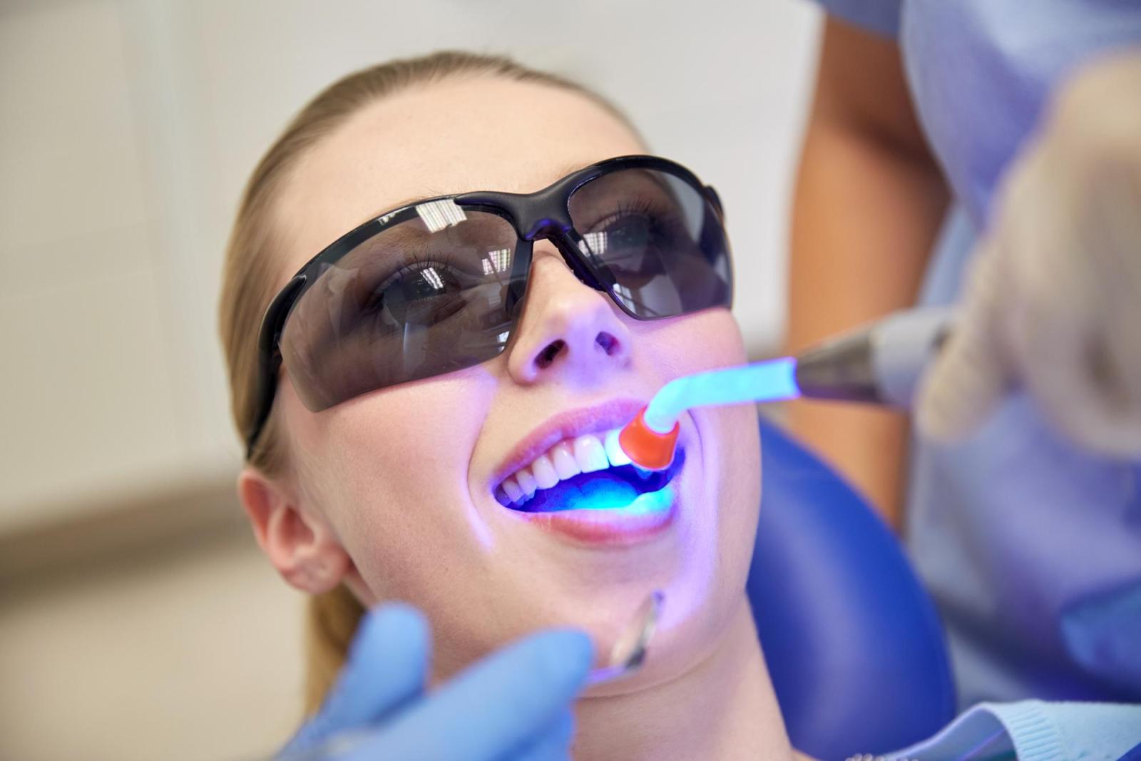 Blanqueamiento Dental: ¿Qué Métodos Son Más Eficaces?