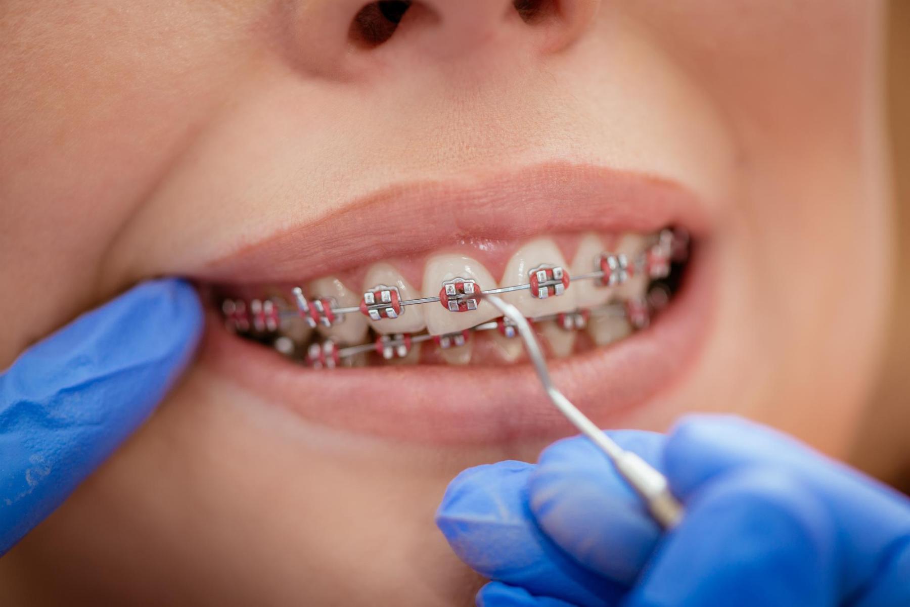 Ortodoncia (brackets, invisible,...)