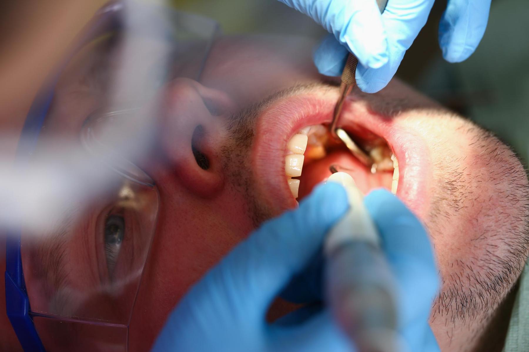 Cirugía oral e implantología
