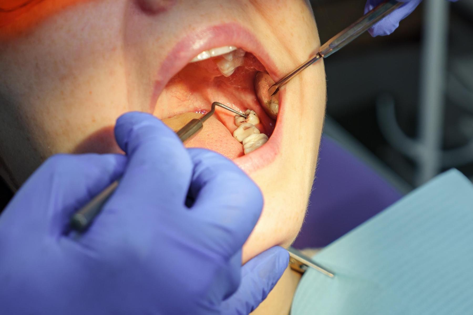 Endodoncia