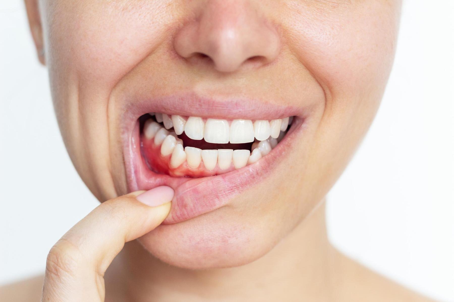 Periodoncia